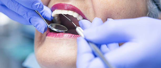 Best Same-Day Emergency Dentist in Bethesda, MD